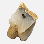金歯画像